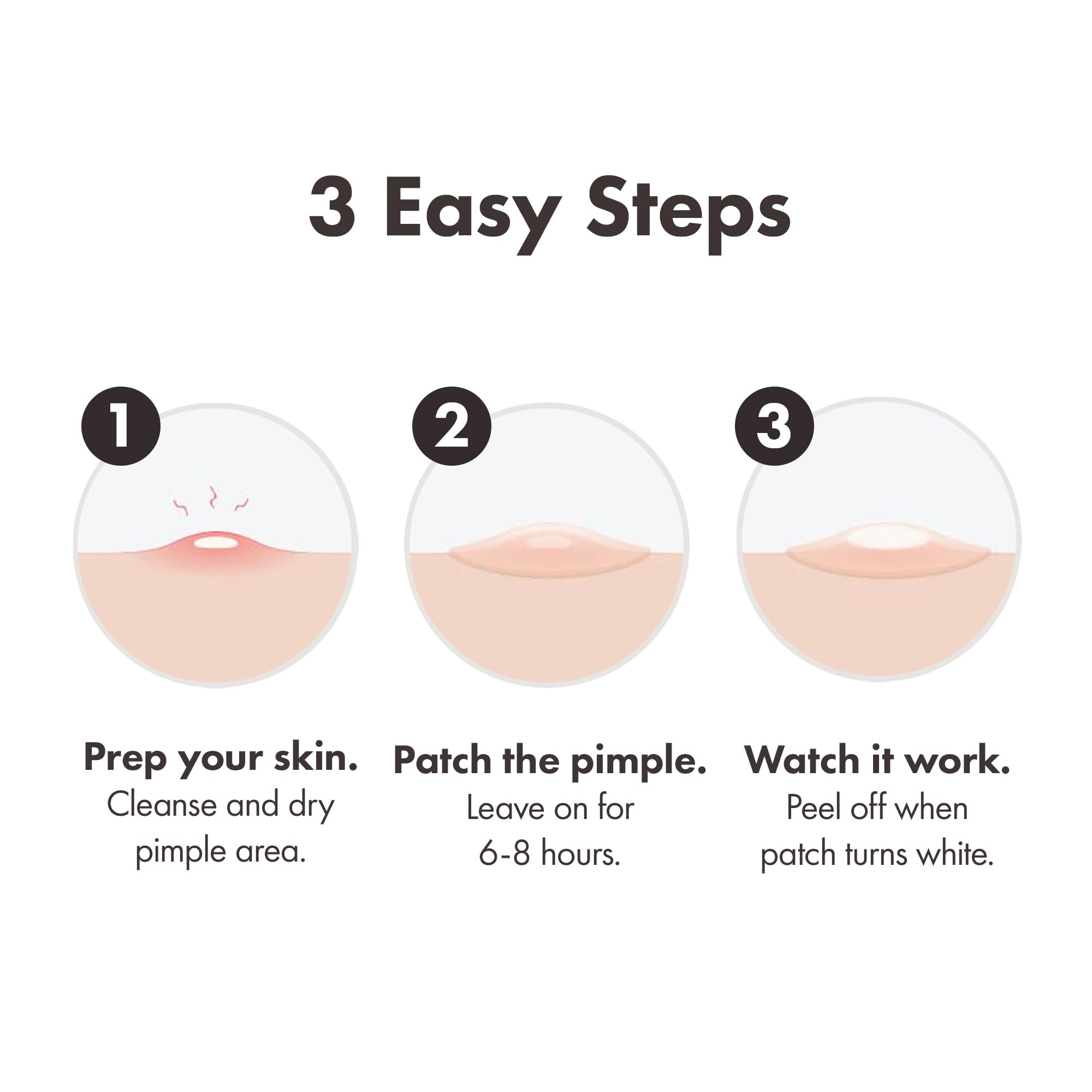 Hero Cosmetics - Mighty Patch Original Spot Patches (144 Count)