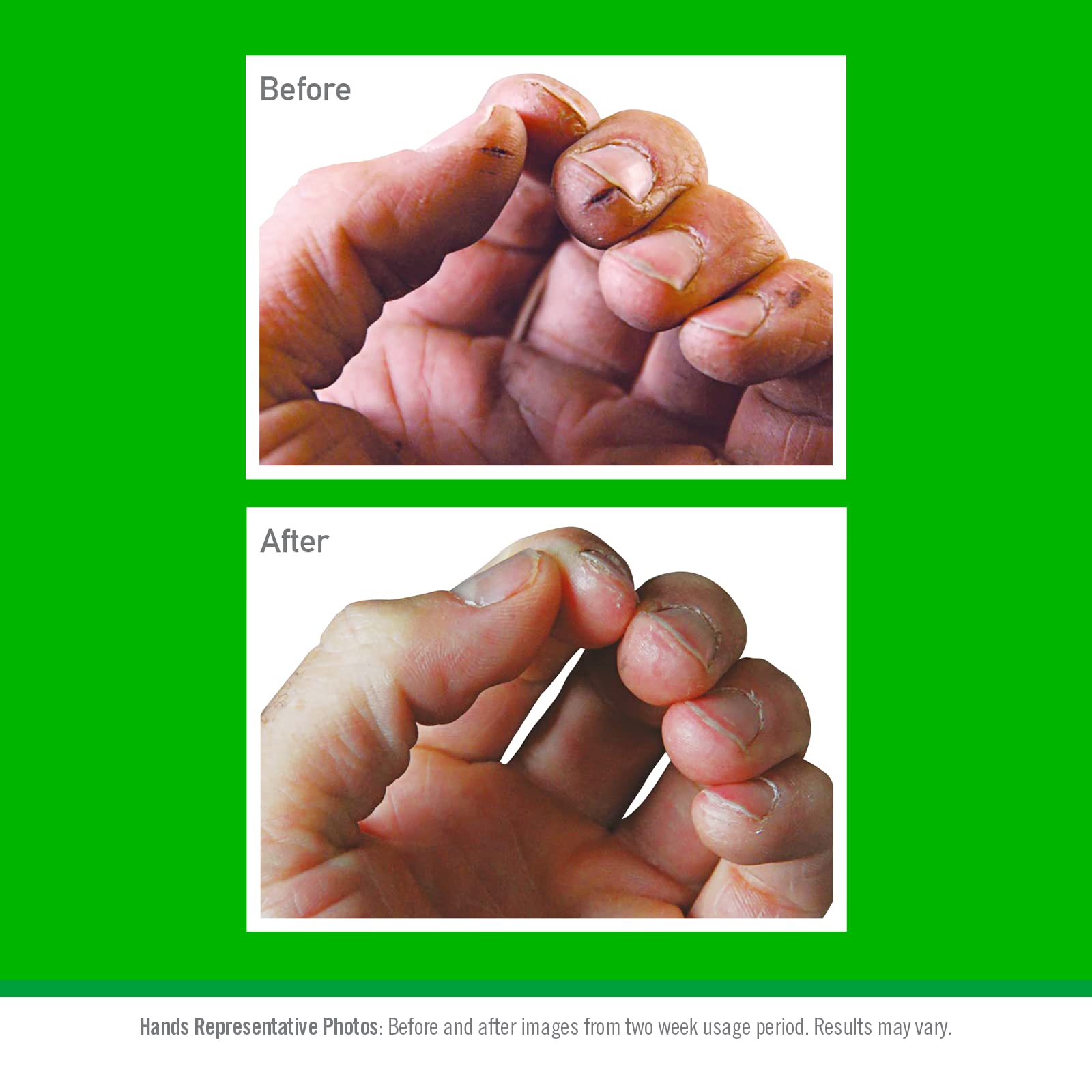 O'Keeffe's Working Hands Hand Cream (190ml)