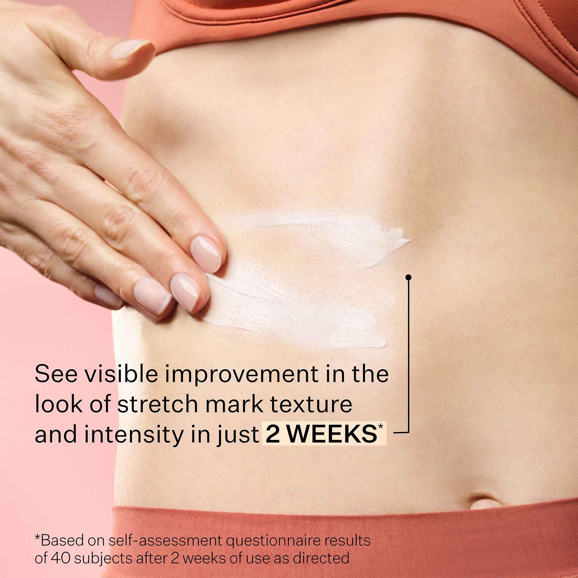 StriVectin SD Advanced Plus Intensive Moisturizer for Wrinkles & Stretchmarks | 120 ml | Unisex Adult 8