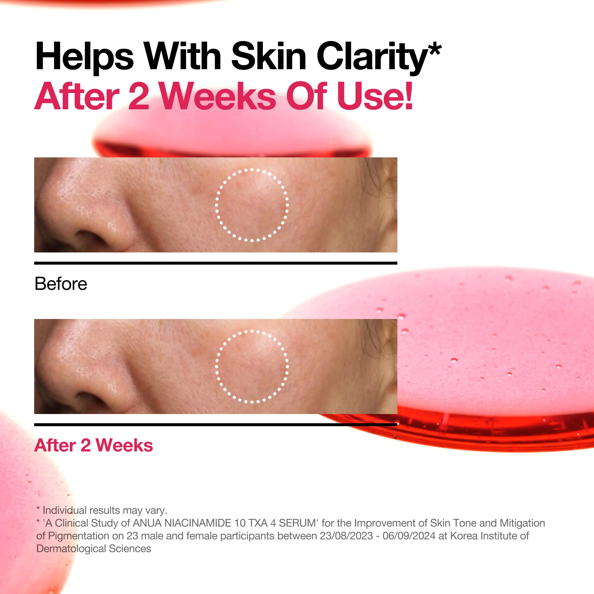 ANUA 10% Niacinamide + 4% Tranexamic Acid Serum with Ceramides & Hyaluronic Acid (30g) 4