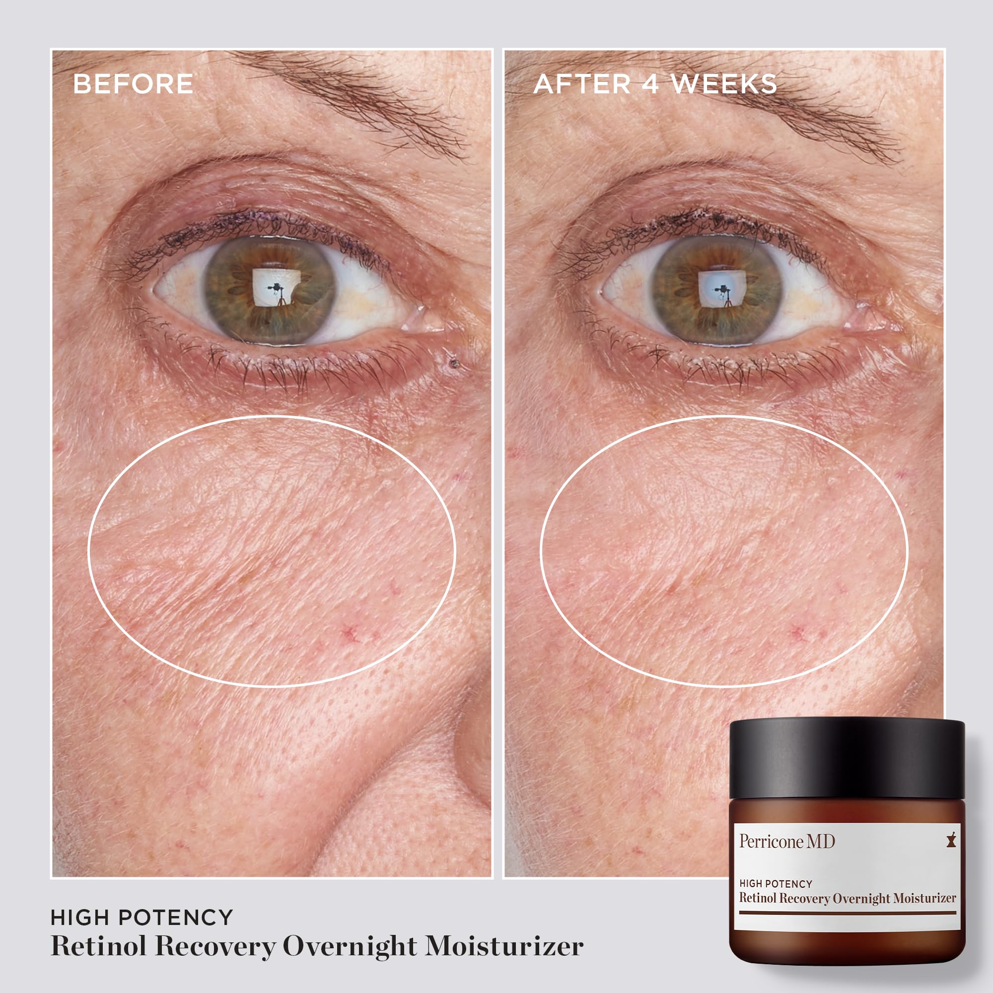 Perricone MD High Potency Retinol Recovery Overnight Moisturizer Cream 59 ml for Unisex Adult 4